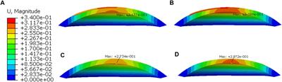 Effects of Laser In Situ Keratomileusis and Small-Incision Lenticule Extraction on Corneal Biomechanical Behavior: A Finite Element Analysis